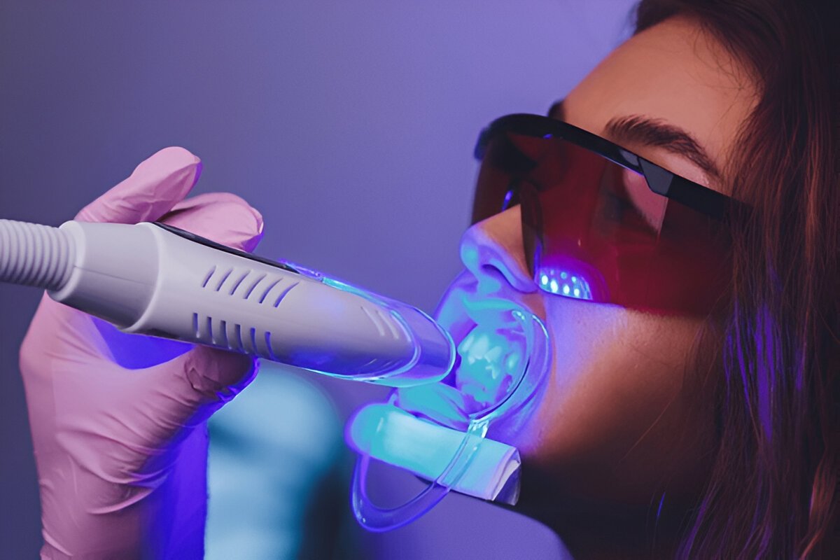 Laser Dentistry