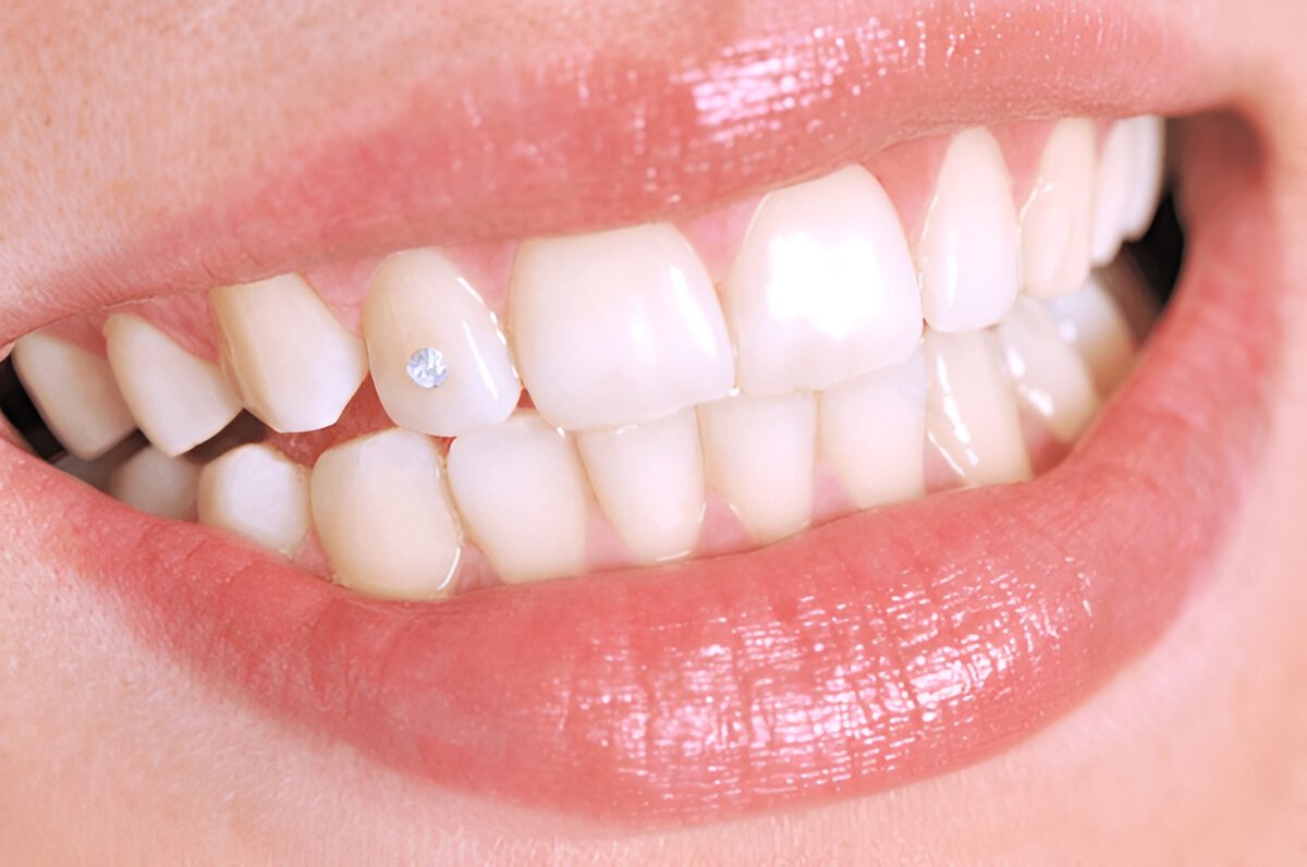 Teeth Jewelry