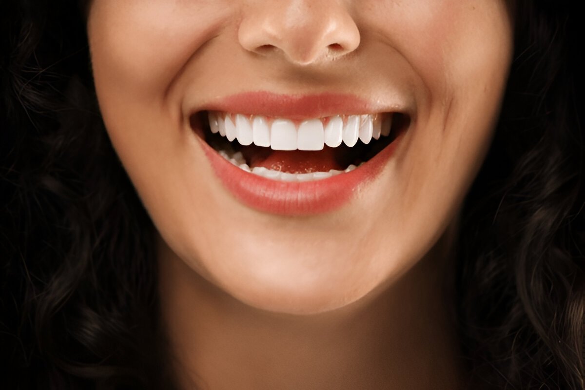 Teeth Whitening